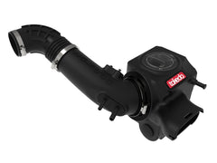 aFe POWER Momentum GT Pro Dry S Intake System 16-19 Ford Fiesta ST L4-1.6L (t)